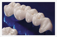 ZIRCONIUM CROWN