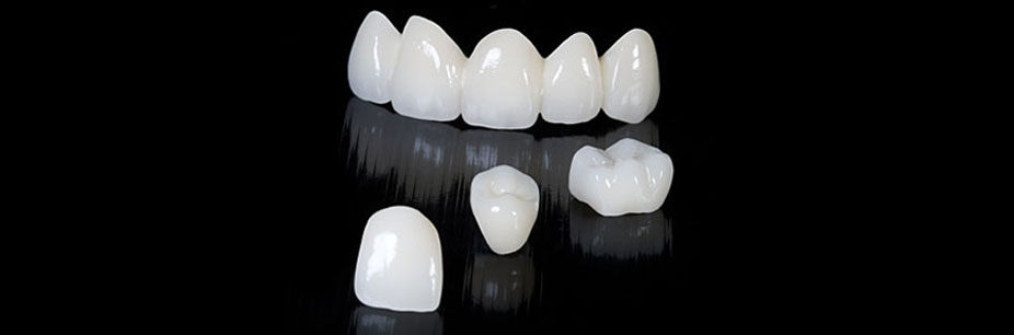 ZIRCONIUM CROWN