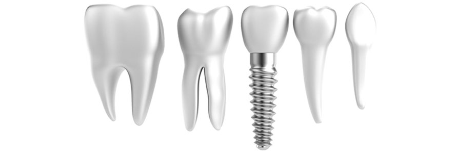 ZIRCONIUM IMPLANT